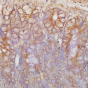 Polyclonal Antibody