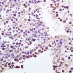 Polyclonal Antibody