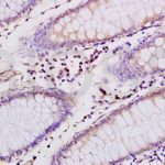 Polyclonal Antibody