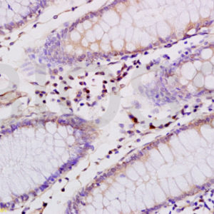 Polyclonal Antibody