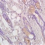 Polyclonal Antibody