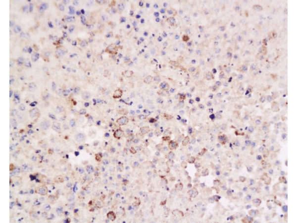 Polyclonal Antibody