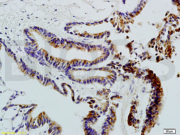 Polyclonal Antibody