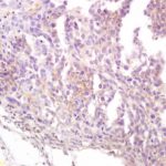 Polyclonal Antibody