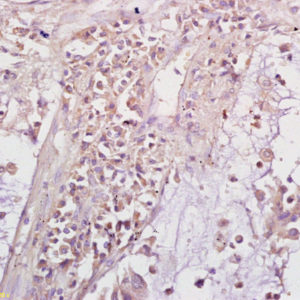 Polyclonal Antibody