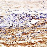 Polyclonal Antibody