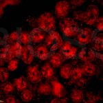 Polyclonal Antibody
