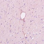 Polyclonal Antibody