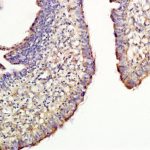 Polyclonal Antibody