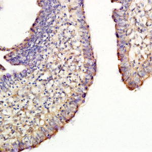 Polyclonal Antibody