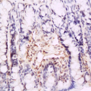 Polyclonal Antibody