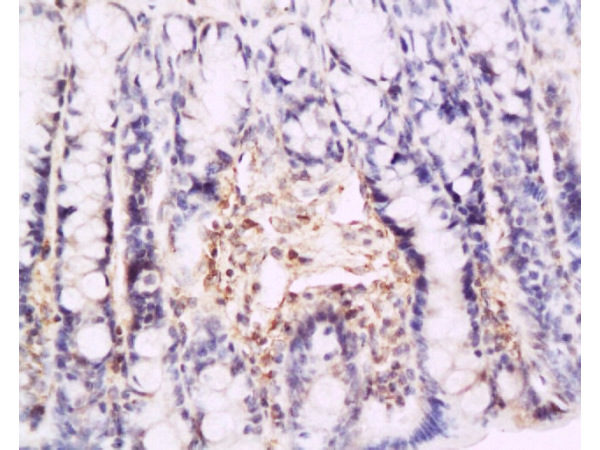 Polyclonal Antibody