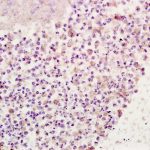 Polyclonal Antibody