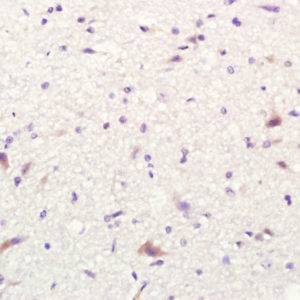 Polyclonal Antibody