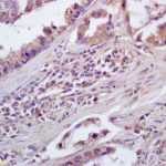 Polyclonal Antibody
