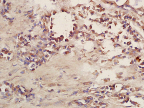 Polyclonal Antibody