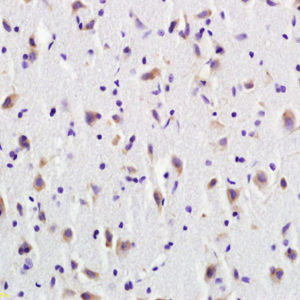 Polyclonal Antibody