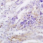 Polyclonal Antibody