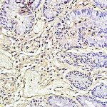 Polyclonal Antibody