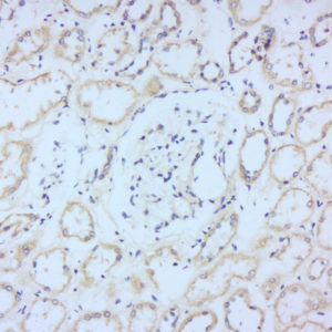 Polyclonal Antibody