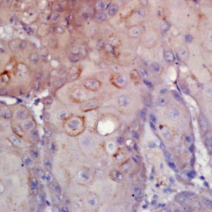 Polyclonal Antibody