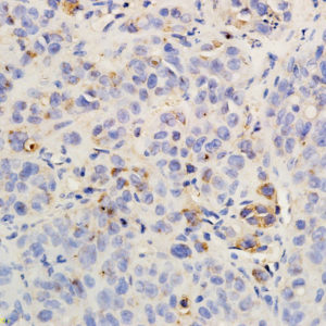 Polyclonal Antibody