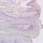 Polyclonal Antibody