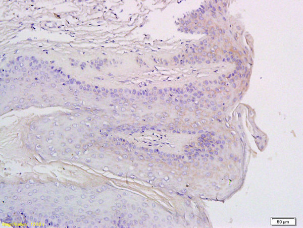 Polyclonal Antibody