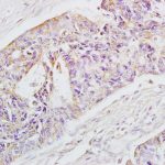 Polyclonal Antibody