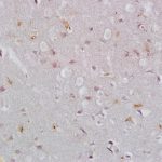 Polyclonal Antibody