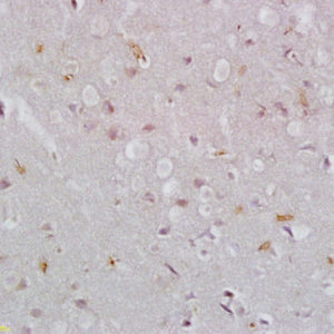 Polyclonal Antibody