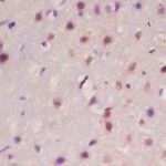 Polyclonal Antibody