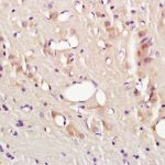 Polyclonal Antibody