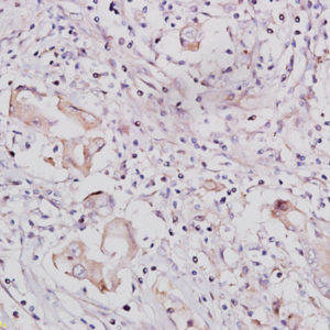 Polyclonal Antibody