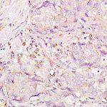 Polyclonal Antibody