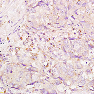 Polyclonal Antibody