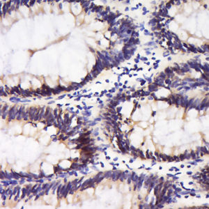 Polyclonal Antibody