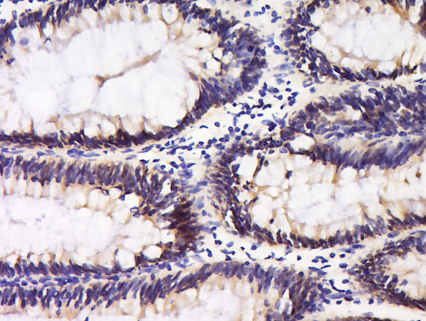 Polyclonal Antibody