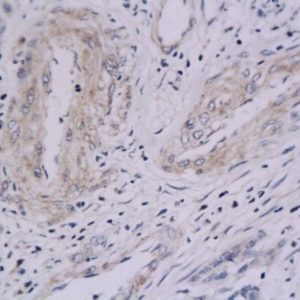 Polyclonal Antibody