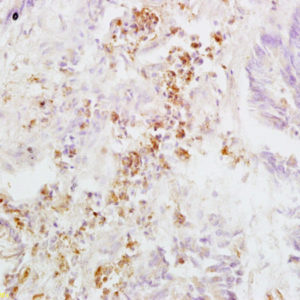 Polyclonal Antibody