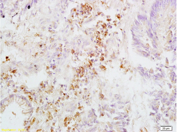 Polyclonal Antibody