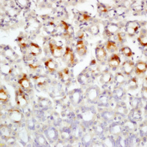 Polyclonal Antibody