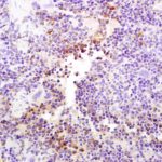 Polyclonal Antibody