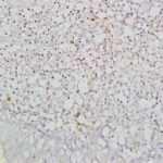 Polyclonal Antibody