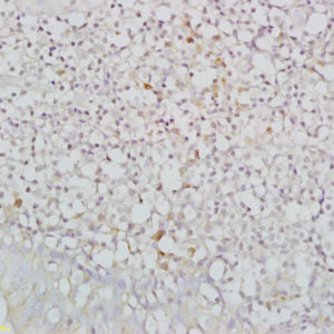 Polyclonal Antibody