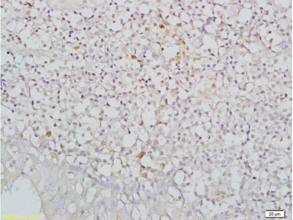 Polyclonal Antibody