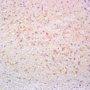 Polyclonal Antibody