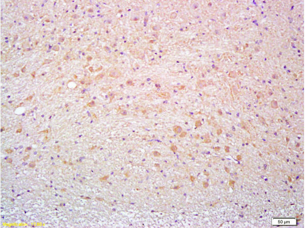 Polyclonal Antibody