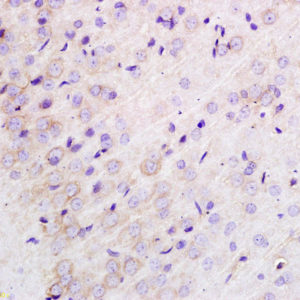 Polyclonal Antibody