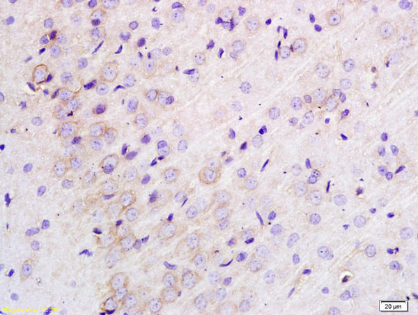 Polyclonal Antibody